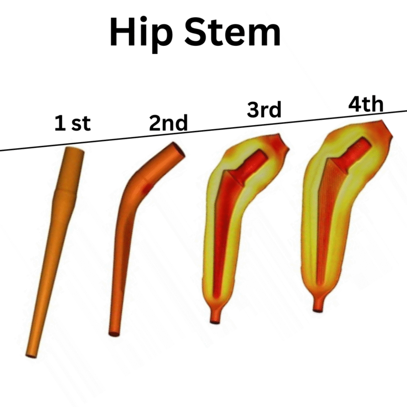 Hip Stem Forging Medical Implant Forging Solutions by Adhvika Forge Tech – Precision Forging for Life-Saving Components