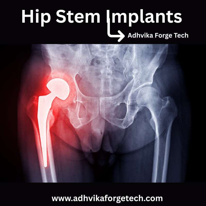 Hip Stem Implants Medical Implant Forging Solutions by Adhvika Forge Tech – Precision Forging for Life-Saving Components